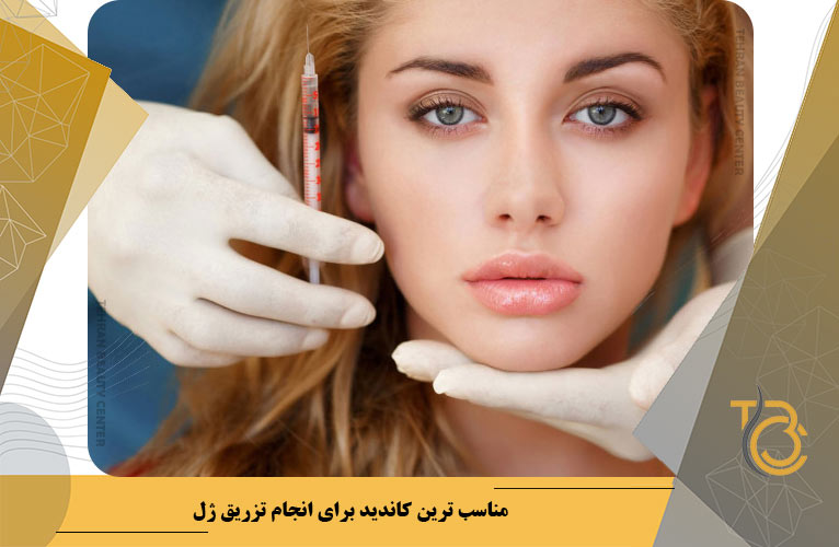 مناسب ترین کاندید برای انجام تزریق ژل