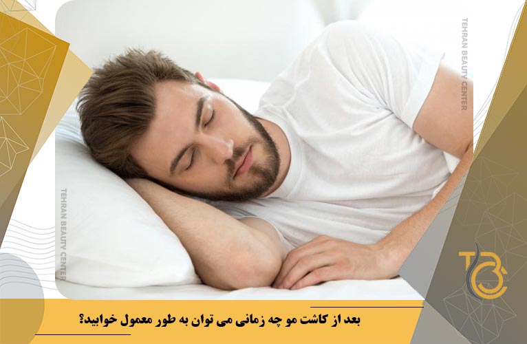 بعد از کاشت مو چه زمانی می توان به طور معمول خوابید؟