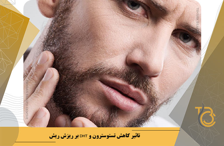 تاثیر کاهش تستوسترون و DHT بر ریزش ریش