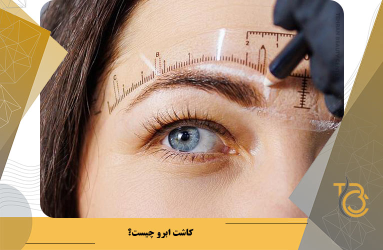 کاشت ابرو چیست