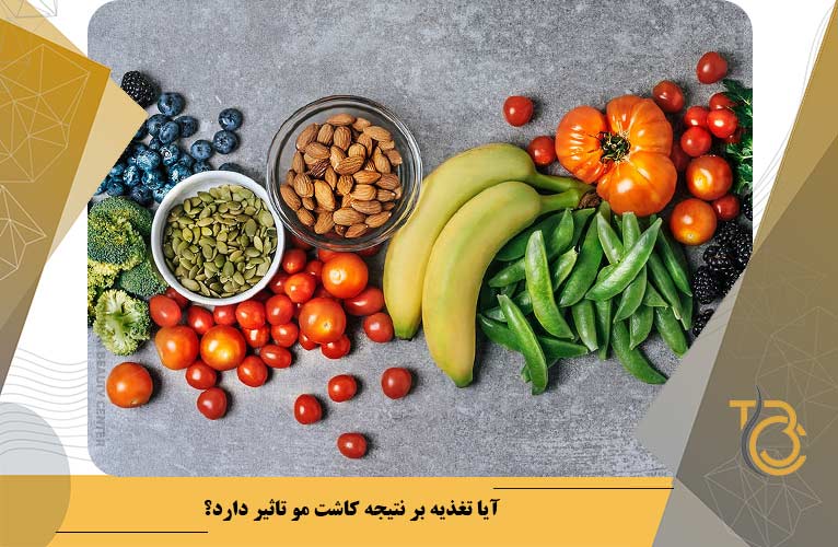 آیا تغذیه بر نتیجه کاشت مو تاثیر دارد؟