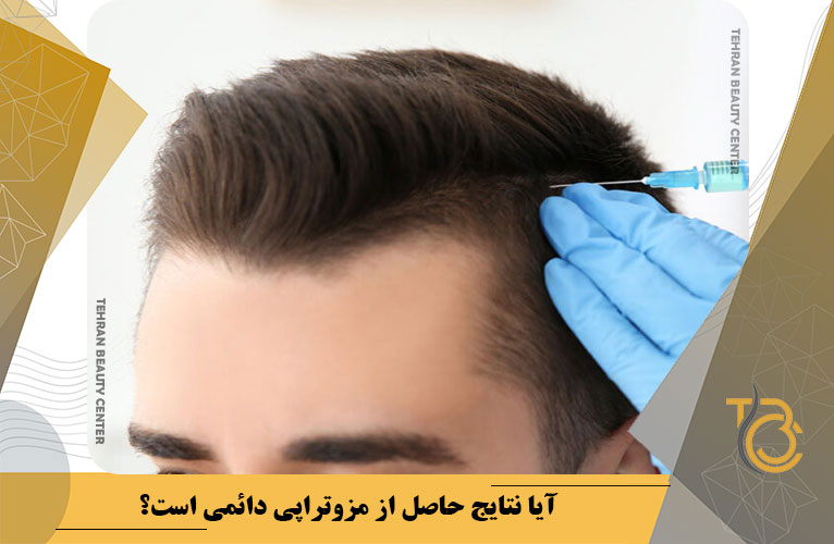 آیا نتایج حاصل از مزوتراپی دائمی است؟