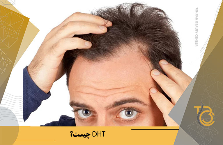 DHT چیست؟