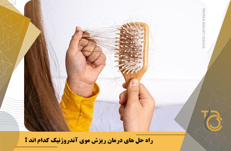 راه حل های درمان ریزش موی آندروژنیک کدام اند ؟