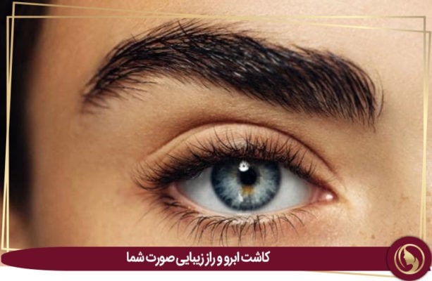 کاشت ابرو