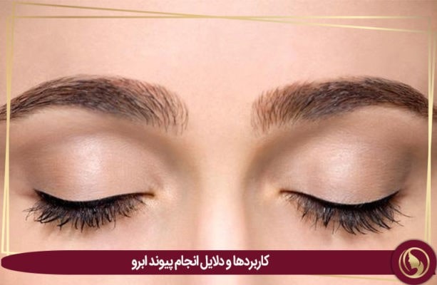 کاشت ابرو طبیعی