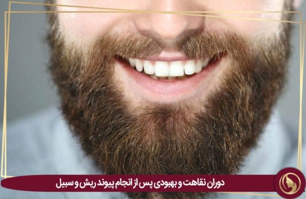 کاشت ریش و سبیل