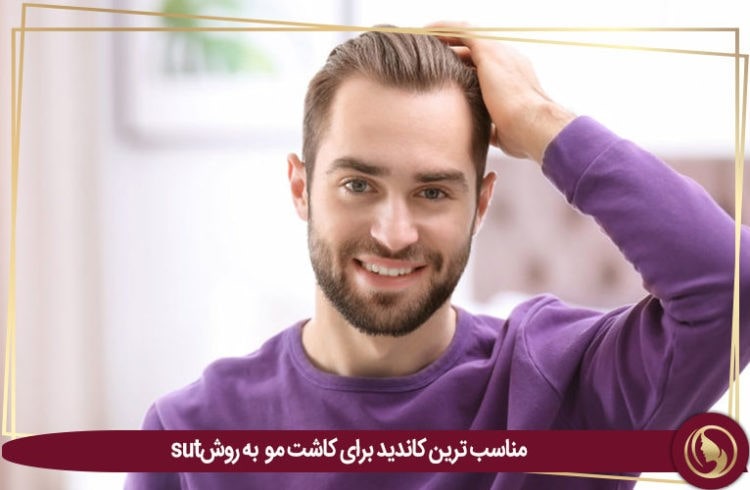 چه کسانی مناسب ترین کاندید برای کاشت مو به روش SUT هستند؟