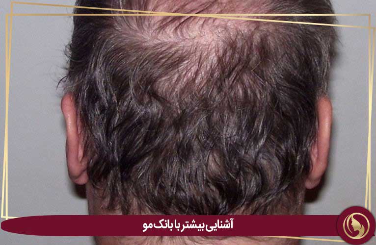 بانک مو