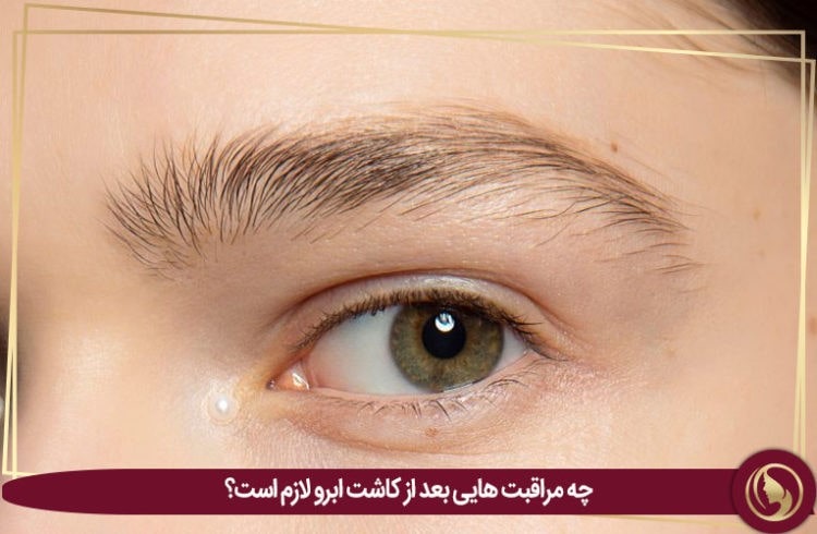 کاشت ابروی طبیعی