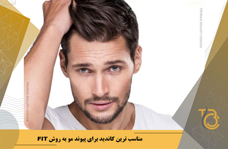 مناسبترین کاندید برای پیوند مو به روش FIT