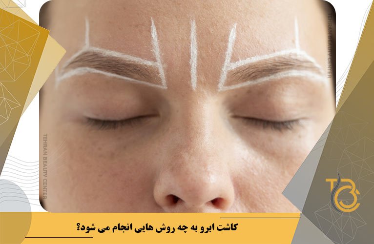 کاشت ابرو به چه روش هایی انجام می شود؟