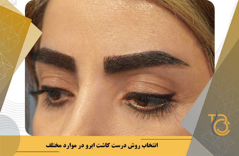 عوارض جانبی و خطرات روش های مختلف کاشت ابرو