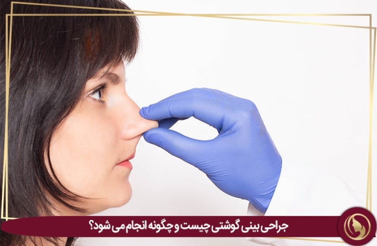 جراحی بینی گوشتی