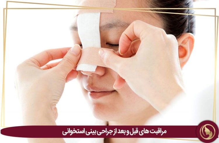 جراحی بینی استخوانی