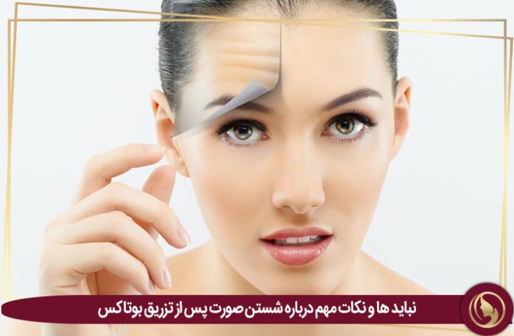 بوتاکس