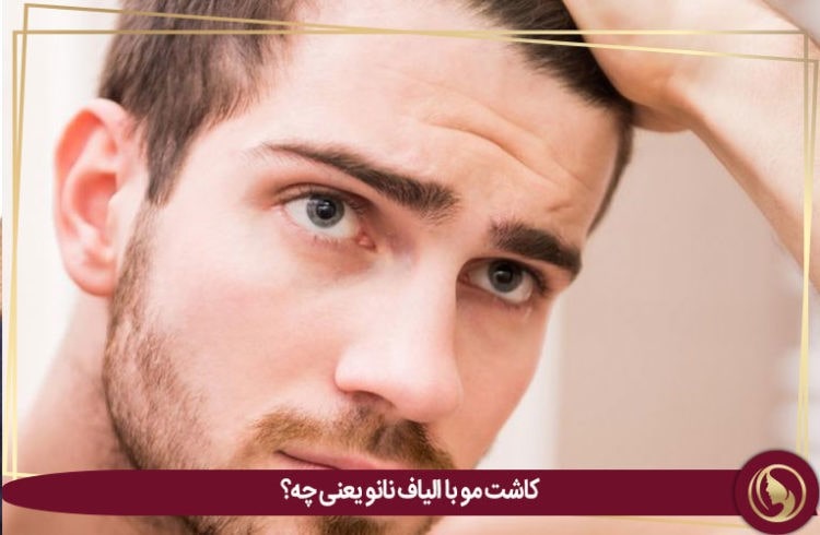 کاشت مو با الیاف نانو