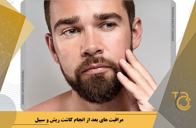 مراقبت های بعد از انجام کاشت ریش و سبیل