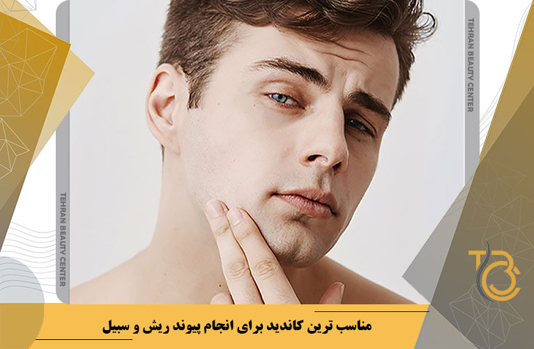 مناسب ترین کاندید برای انجام پیوند ریش و سبیل