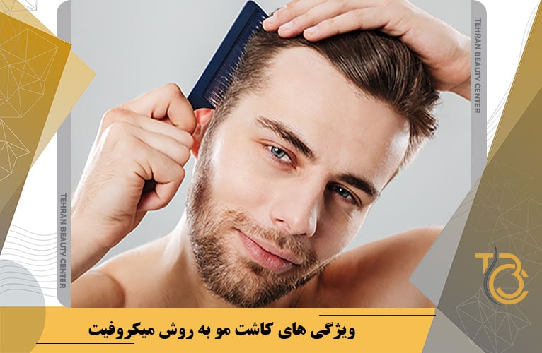 ویژگی های کاشت مو به روش میکروفیت