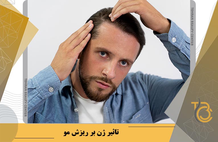 تاثیر ژن بر ریزش مو