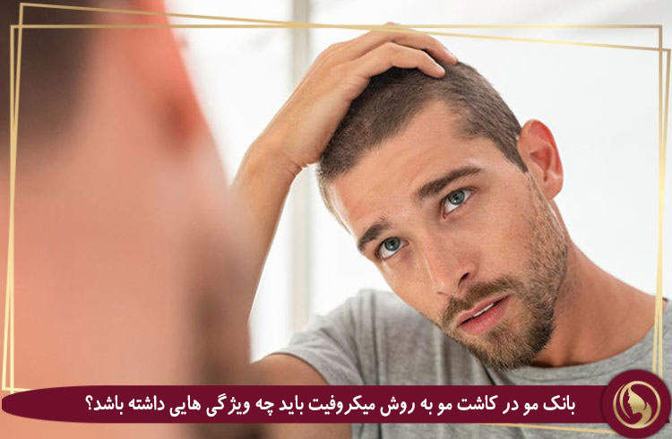 کاشت مو