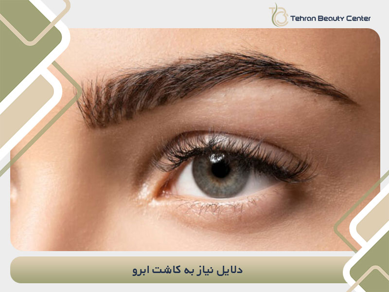 دلایل نیاز به کاشت ابرو