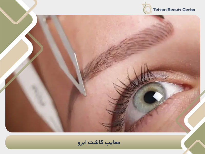 معایب کاشت ابرو