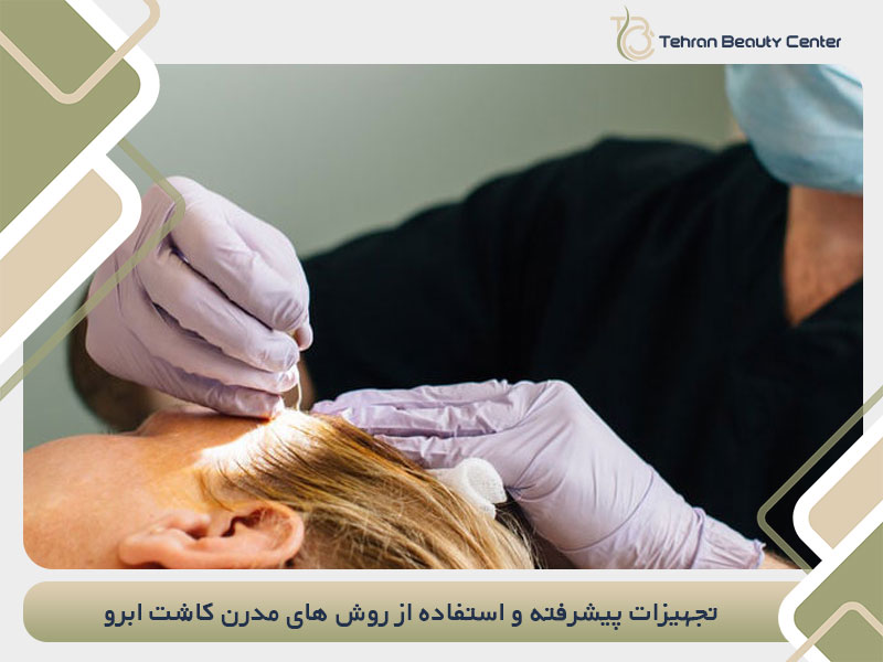 تجهیزات پیشرفته و استفاده از روش های مدرن کاشت ابرو