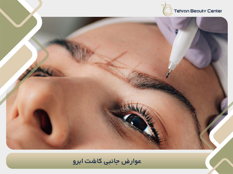عوارض جانبی کاشت ابرو