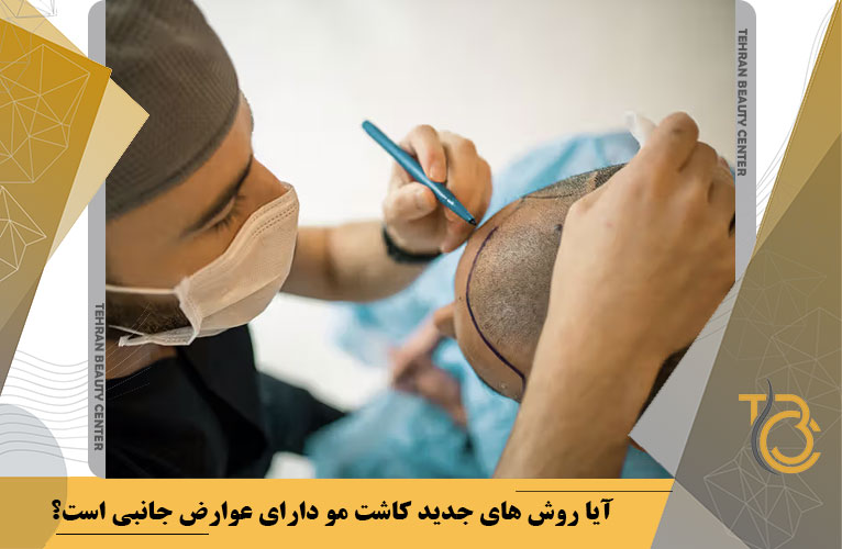 آیا روش های جدید کاشت مو دارای عوارض جانبی است؟