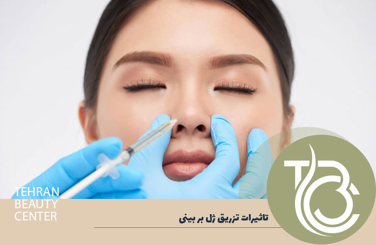 تاثیرات تزریق ژل بینی