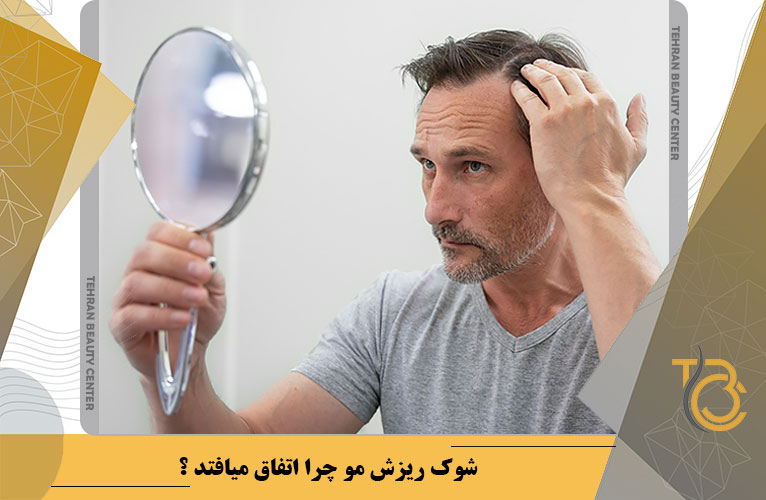 شوک ریزش مو چرا اتفاق می افتد