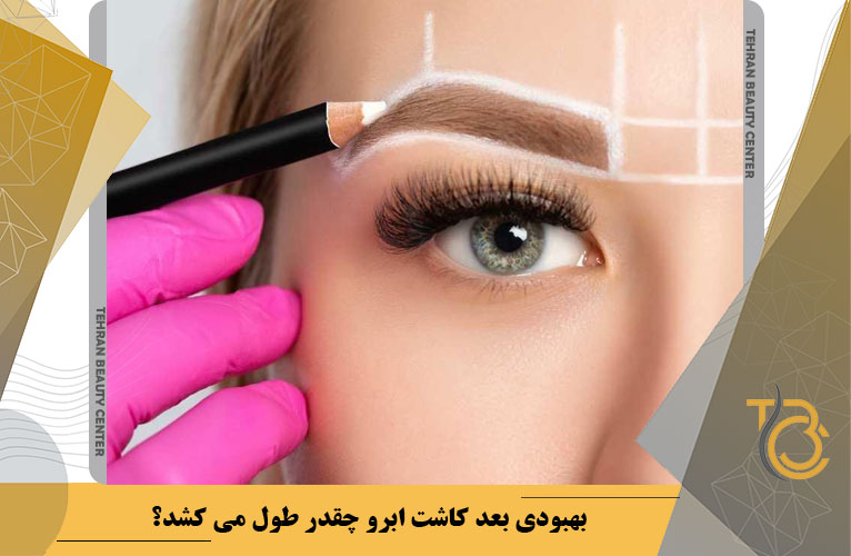 بهبودی بعد کاشت ابرو چقدر طول می کشد؟
