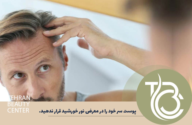 پوست سر خود را در معرض نور خورشید نگه ندارید
