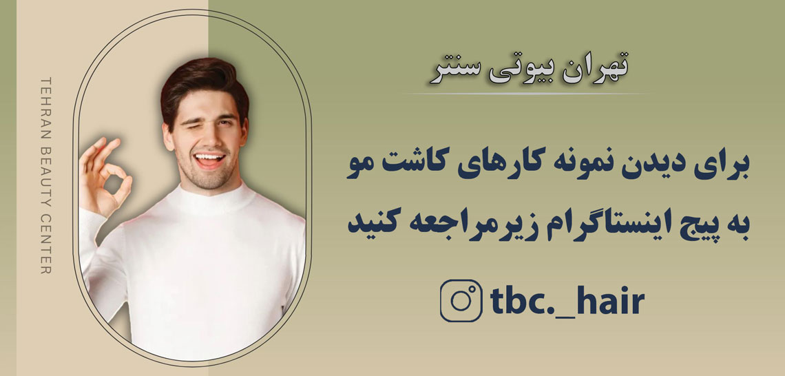 کاشت مو تهران بیوتی سنتر