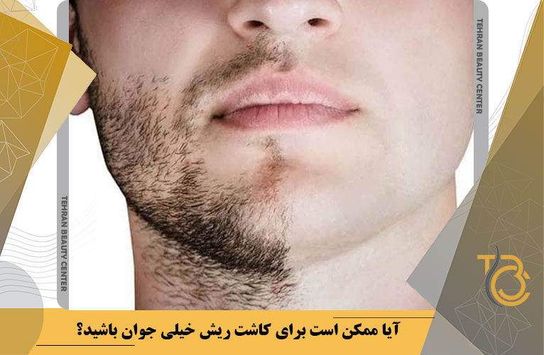آیا ممکن است برای کاشت ریش خیلی جوان باشید؟