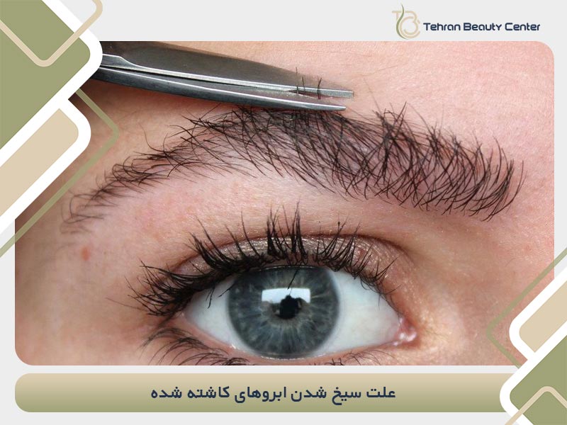 علت سیخ شدن ابروهای کاشته شده