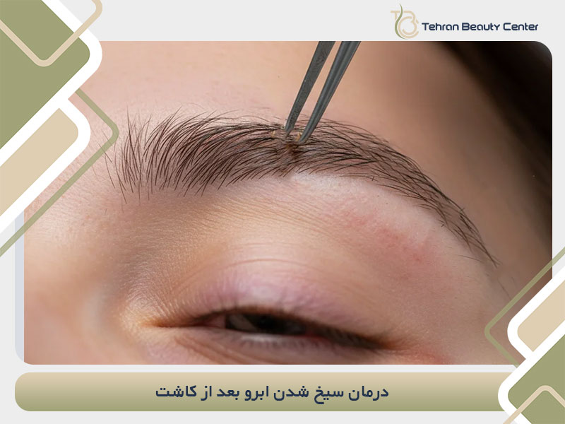 درمان سیخ شدن ابرو بعد از کاشت