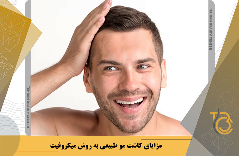 مزایای کاشت مو طبیعی به روش میکروفیت