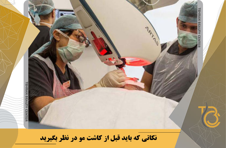 نکاتی که باید قبل از کاشت مو در نظر بگیرید: