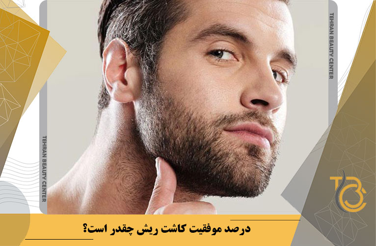 آیا ماندگاری کاشت ریش دائمی است؟