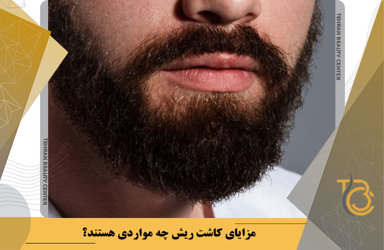 مزایای کاشت ریش چه مواردی هستند؟