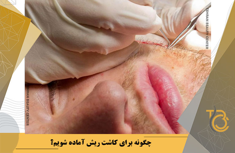 چگونه برای کاشت ریش آماده شویم؟