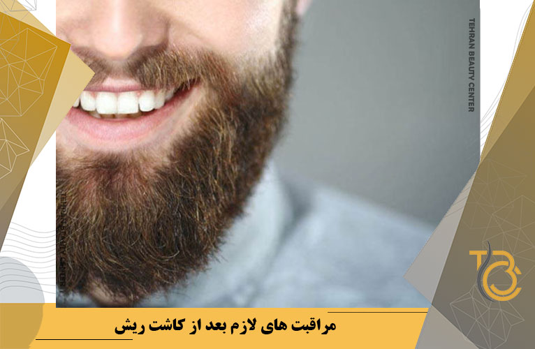مراقبت های لازم بعد از کاشت ریش