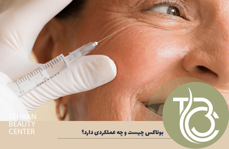 بوتاکس چیست و چه عملکردی دارد؟