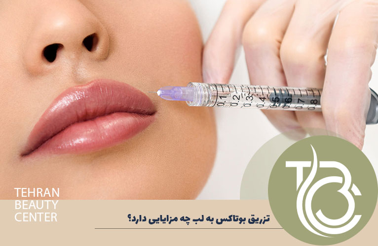 مزایای تزریق بوتاکس به لب