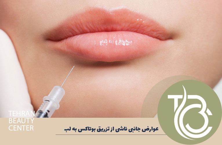 عوارض تزریق بوتاکس لب