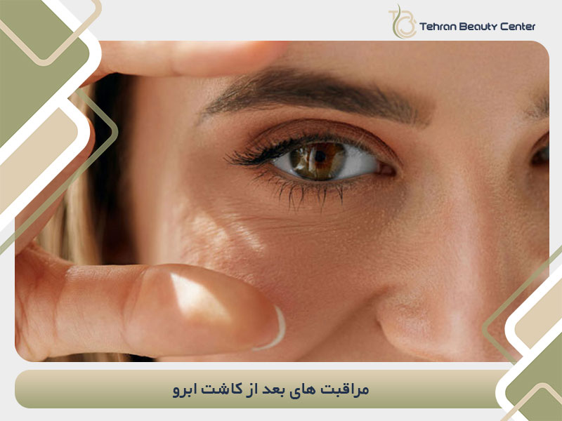 مراقبت های بعد از کاشت ابرو