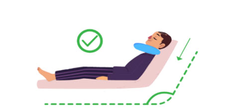 مراقبت های بعد از بلفاروپلاستی